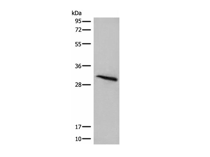 ITM2B Polyclonal Antibody Reactivity Human