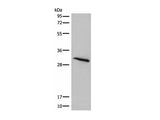 ITM2B Polyclonal Antibody Reactivity Human