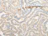 CELA3A Polyclonal Antibody