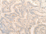 PITPNB Polyclonal Antibody