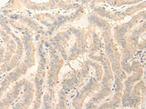 ERP27 Polyclonal Antibody