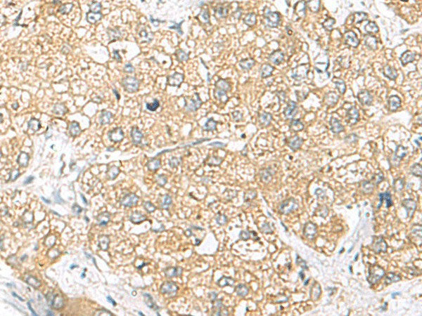 SH3GL2 Polyclonal Antibody