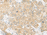 SH3GL2 Polyclonal Antibody