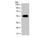 HAS3 Polyclonal Antibody