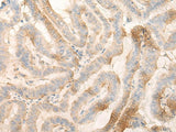 MPPED2 Polyclonal Antibody