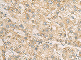 STX5 Polyclonal Antibody