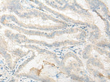 DNASE1L1 Polyclonal Antibody