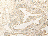 DIMT1 Polyclonal Antibody