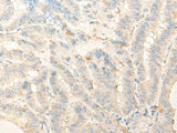 DIMT1 Polyclonal Antibody