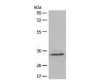 DIMT1 Polyclonal Antibody