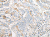 TMEM248 Polyclonal Antibody