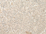 FYTTD1 Polyclonal Antibody