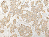 DHRS7 Polyclonal Antibody