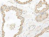DHRS7 Polyclonal Antibody