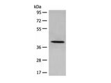 DHRS7 Polyclonal Antibody