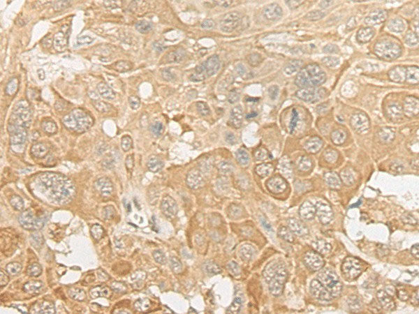ROM1 Polyclonal Antibody