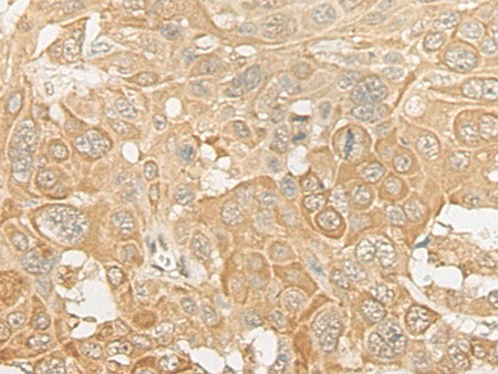ROM1 Polyclonal Antibody