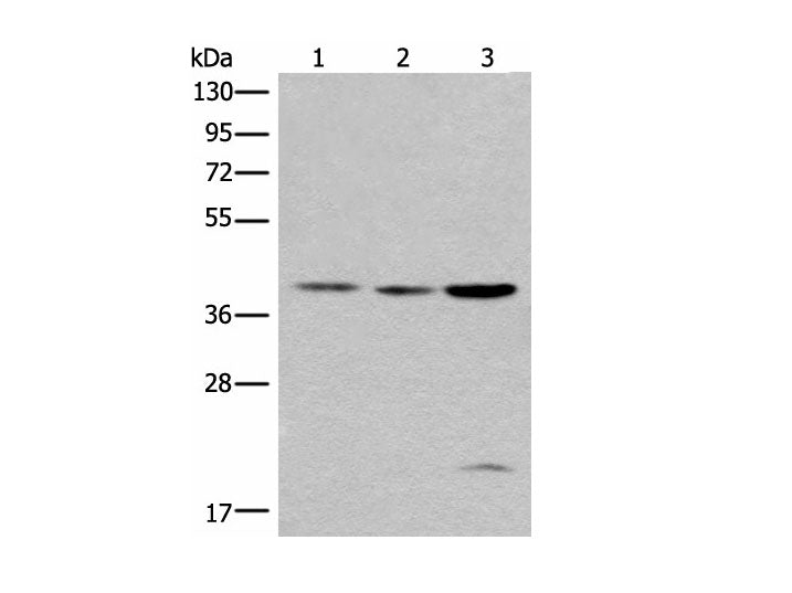 ROM1 Polyclonal Antibody