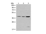 ROM1 Polyclonal Antibody