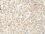 OTX1 Polyclonal Antibody