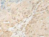 OTX1 Polyclonal Antibody