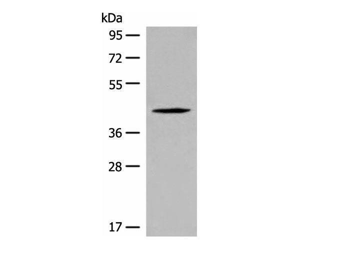 QTRT1 Polyclonal Antibody