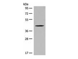 QTRT1 Polyclonal Antibody