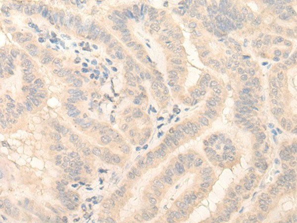 HMBS Polyclonal Antibody Reactivity Human