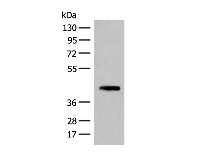 SMS Polyclonal Antibody Reactivity Human