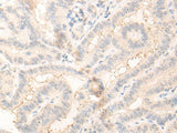 RADIL Polyclonal Antibody Reactivity Human