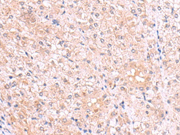 PISD Polyclonal Antibody Reactivity Human