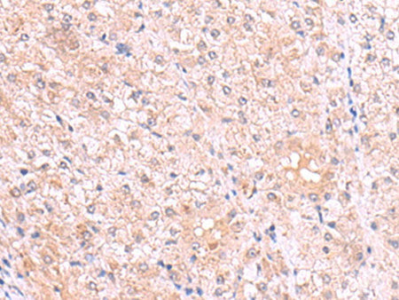 PISD Polyclonal Antibody Reactivity Human