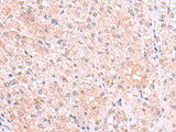 PISD Polyclonal Antibody Reactivity Human