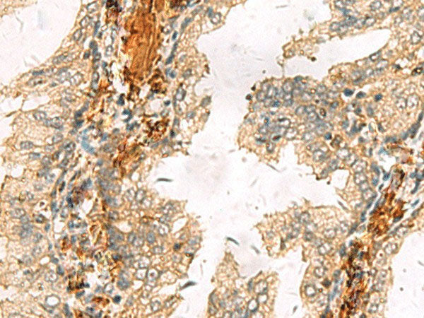 ACTC1 Polyclonal Antibody Reactivity Human
