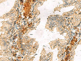 ACTC1 Polyclonal Antibody Reactivity Human