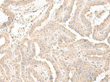 ERGIC3 Polyclonal Antibody