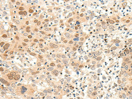 ARMC8 Polyclonal Antibody Reactivity Human