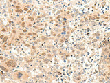 ARMC8 Polyclonal Antibody Reactivity Human