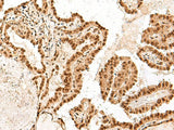 ARMC8 Polyclonal Antibody Reactivity Human