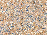 DNAJC14 Polyclonal Antibody Reactivity Human