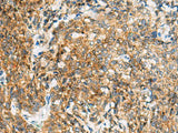 TUFT1 Polyclonal Antibody