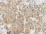 TUFT1 Polyclonal Antibody