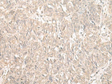 ILKAP Polyclonal Antibody Reactivity Human