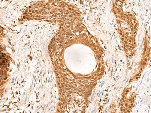 RMND5B Polyclonal Antibody Reactivity Human