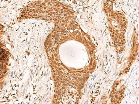 RMND5B Polyclonal Antibody Reactivity Human
