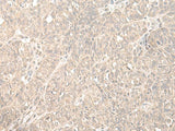 HENMT1 Polyclonal Antibody Reactivity Human
