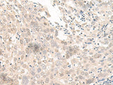 OLA1 Polyclonal Antibody Reactivity Human