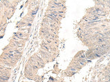 OLA1 Polyclonal Antibody Reactivity Human