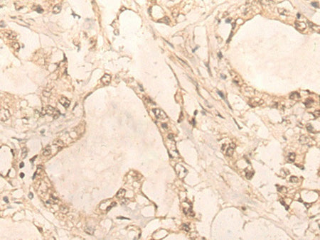 PLEKHA1 Polyclonal Antibody Reactivity Human