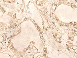 PLEKHA1 Polyclonal Antibody Reactivity Human